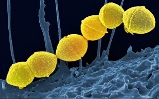 Резкое увеличение случаев токсического шока в Японии