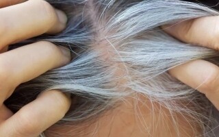 Graying as a Defense Mechanism Against Skin Cancer